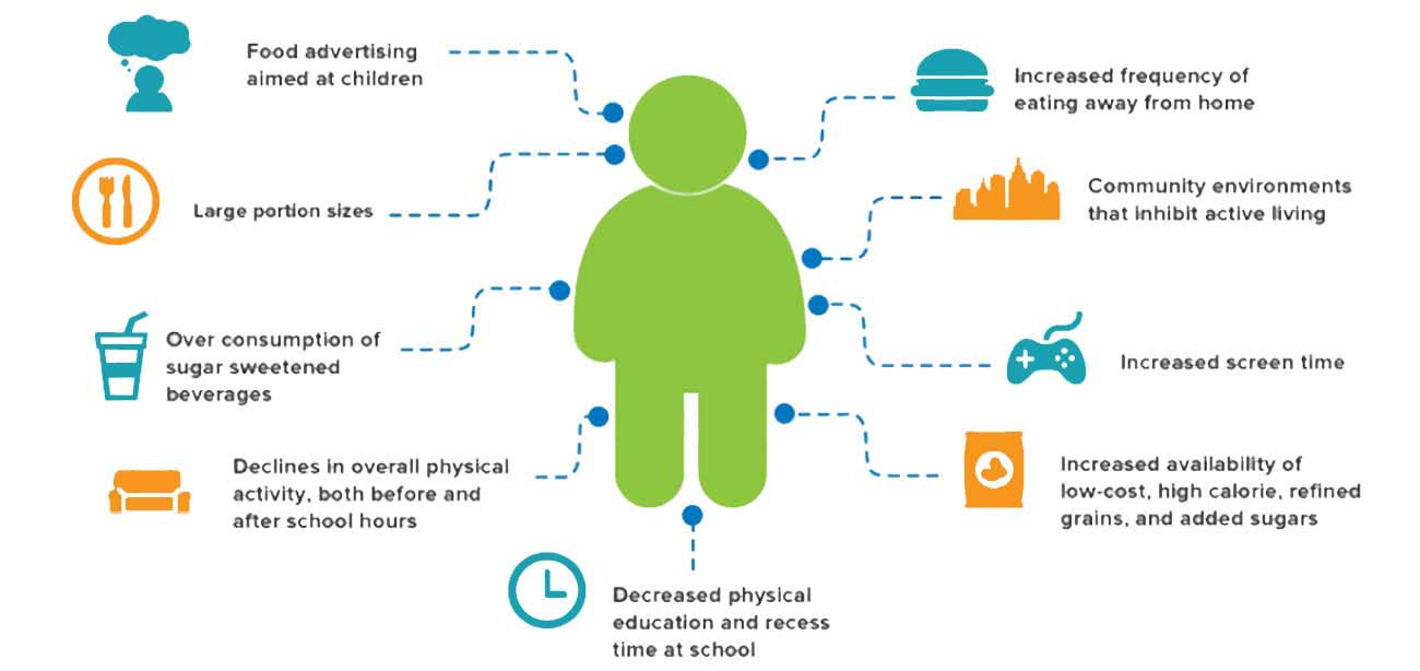 causes of obesity in children